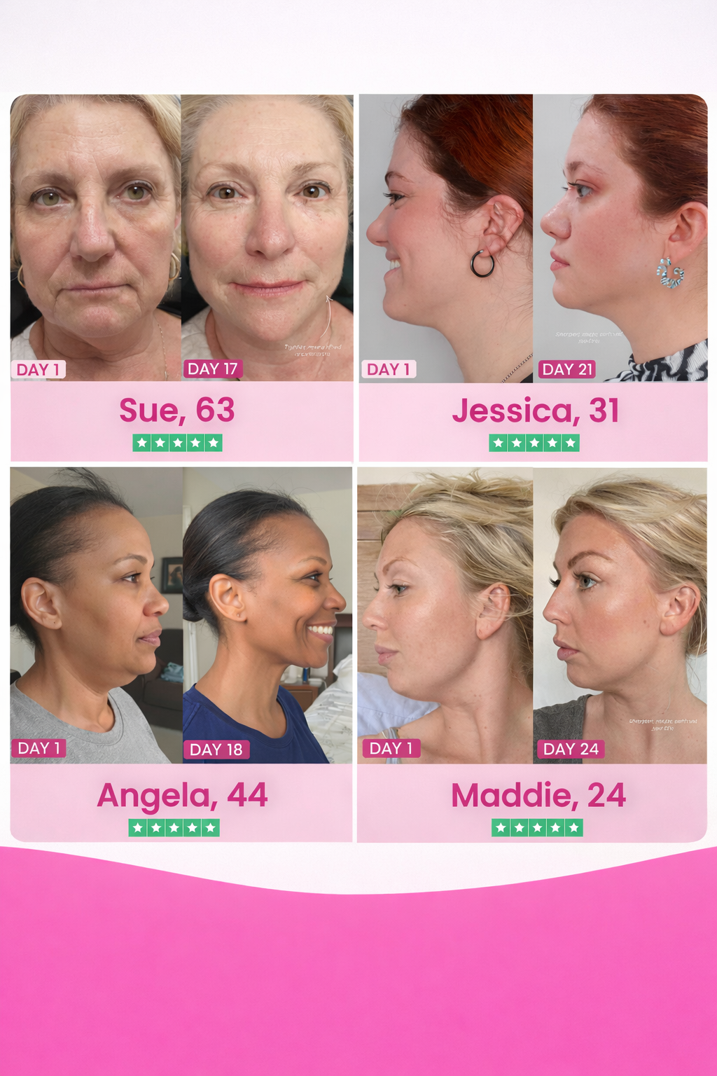 Avena® Collagen Lift & Tight Facial Strap