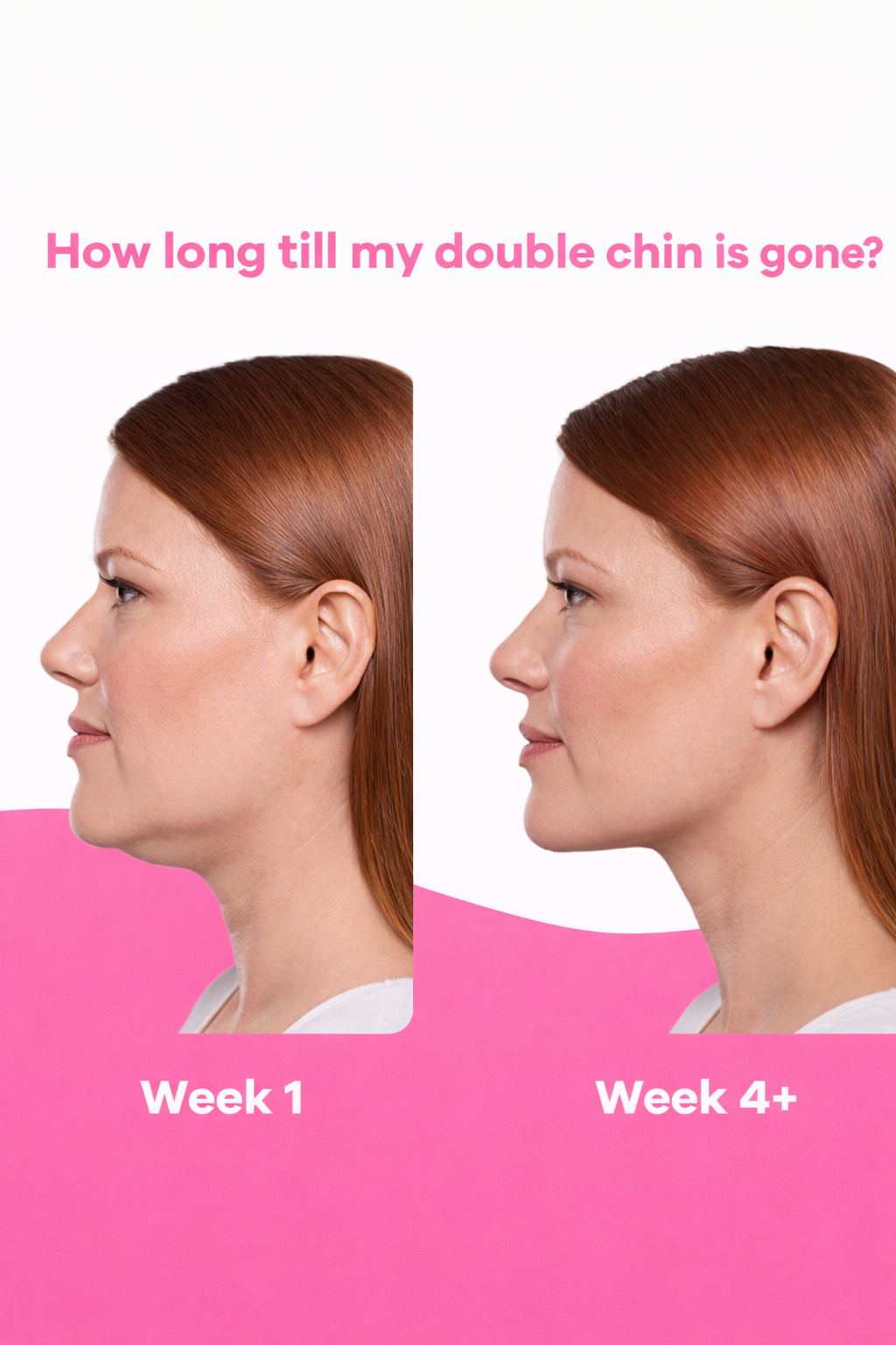 Avena® Collagen Lift & Tight Facial Strap